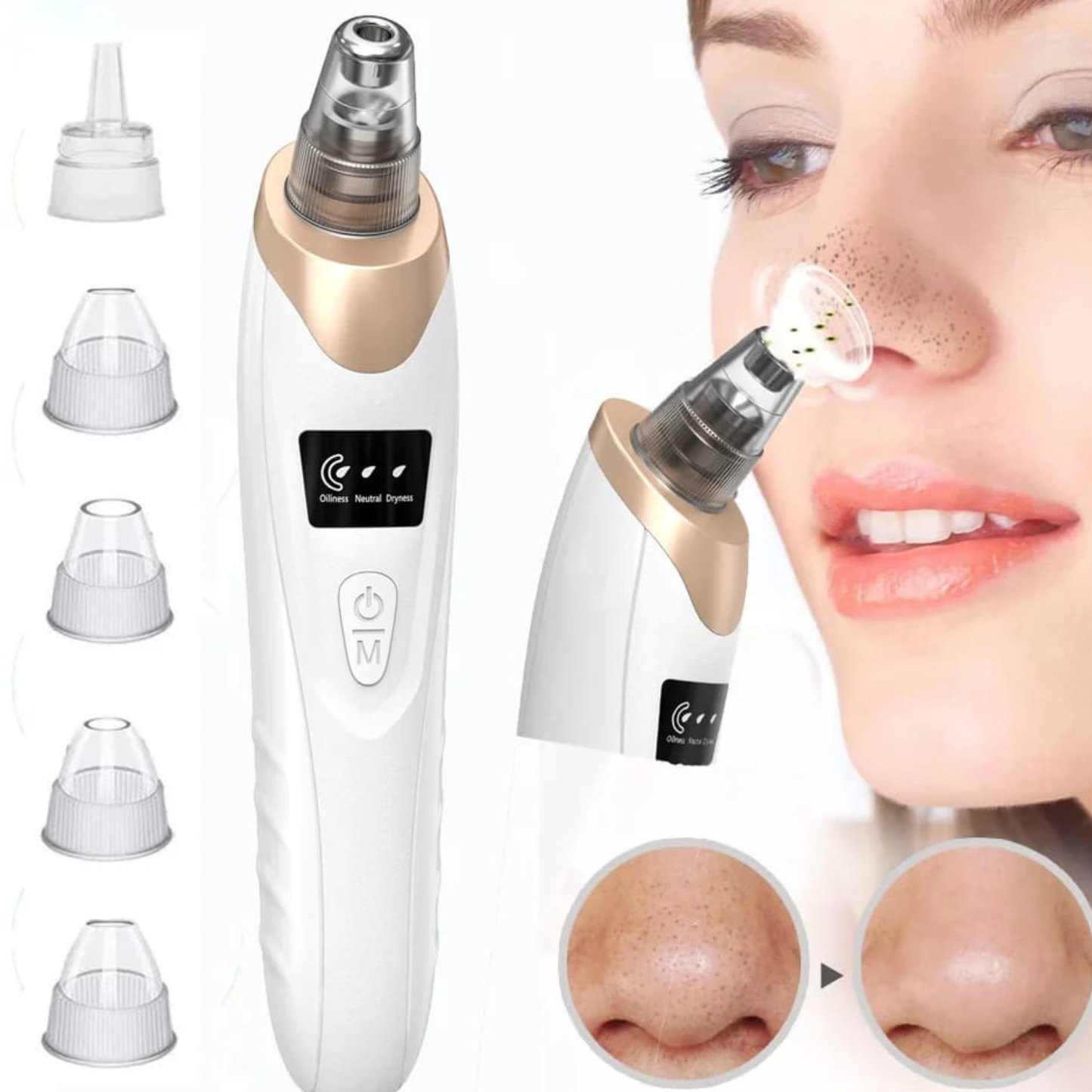 5 in 1 Black Head Remover machine