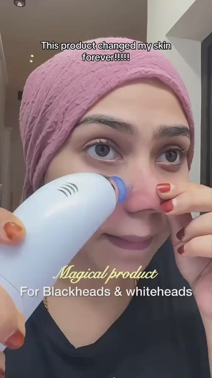 Blackhead Remover Vacuum