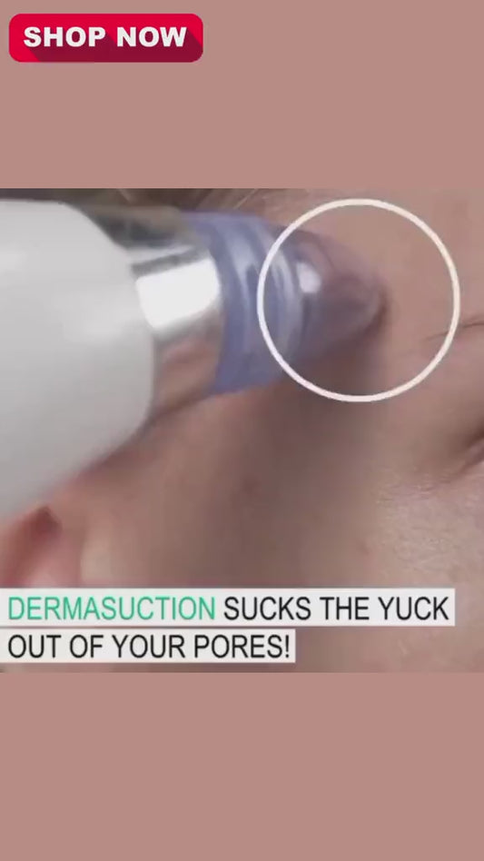 Blackhead Remover Vacuum